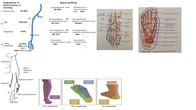 Peripheral arterial disease, part 2: Revascularization, CLI concepts, Questions/answers- Elias Hanna