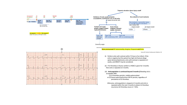 STEMI part 3 +Approach to all MIs and troponin grades + subtle STEMI cases (OMI) + LV thrombus