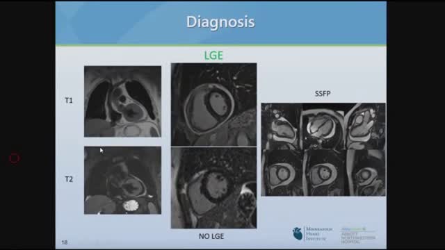 David Lin, MD - Diagnosis and Management of Pericarditis