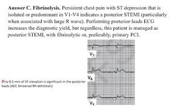 Myocardial infarction 2: board questions     Elias Hanna, Univ of Iowa
