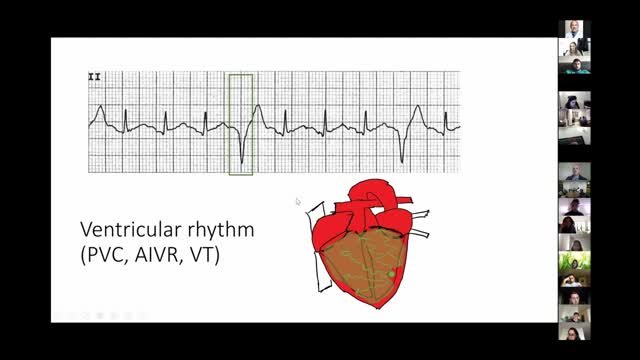Wide Complex Tachycardia with Dr  Petrovic 11 4