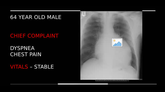 64 year old with chest pain