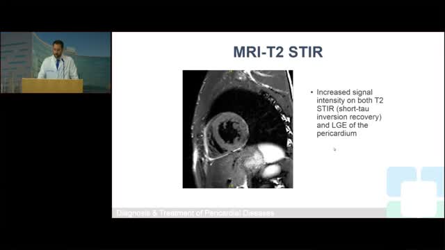 Pericardial Cases: Does Pericarditis Ever Get Better?