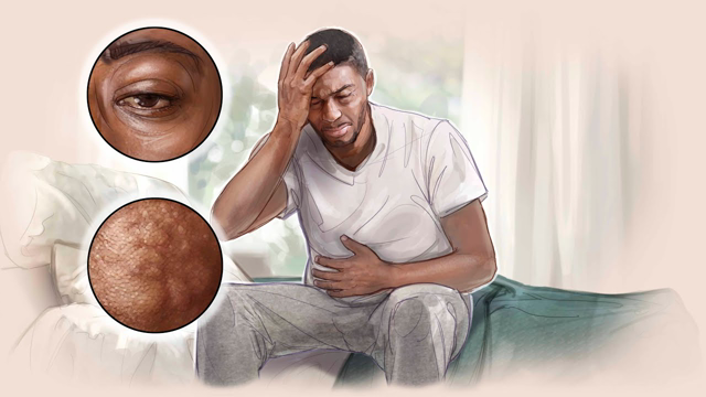 Medical Mystery Solved â€” Hunting for a Diagnosis | NEJM