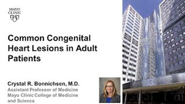 Common Congenital Heart Lesions in Adult Patients