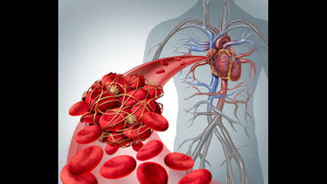 Anti platelet Treatment in a fib and Cad